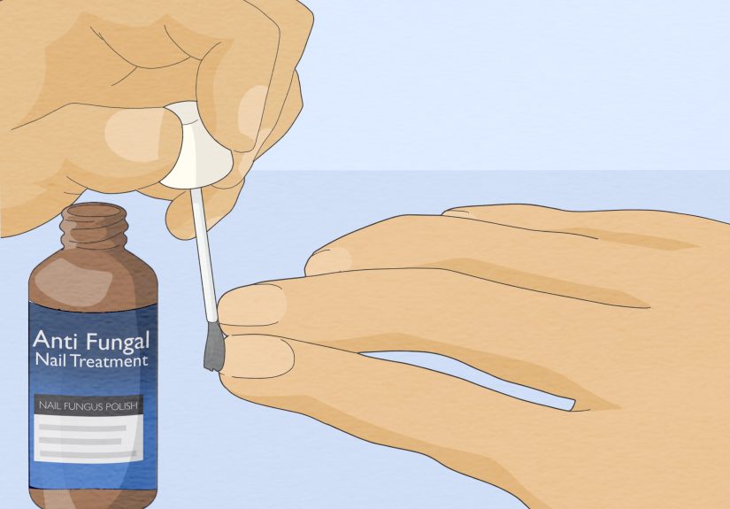 3 Ways to Get Rid of White Spots on Your Nails