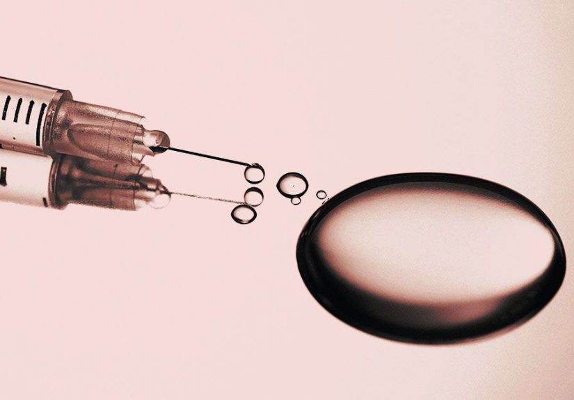 Botox for Sweating: How it Works, Target Areas, and Effectiveness