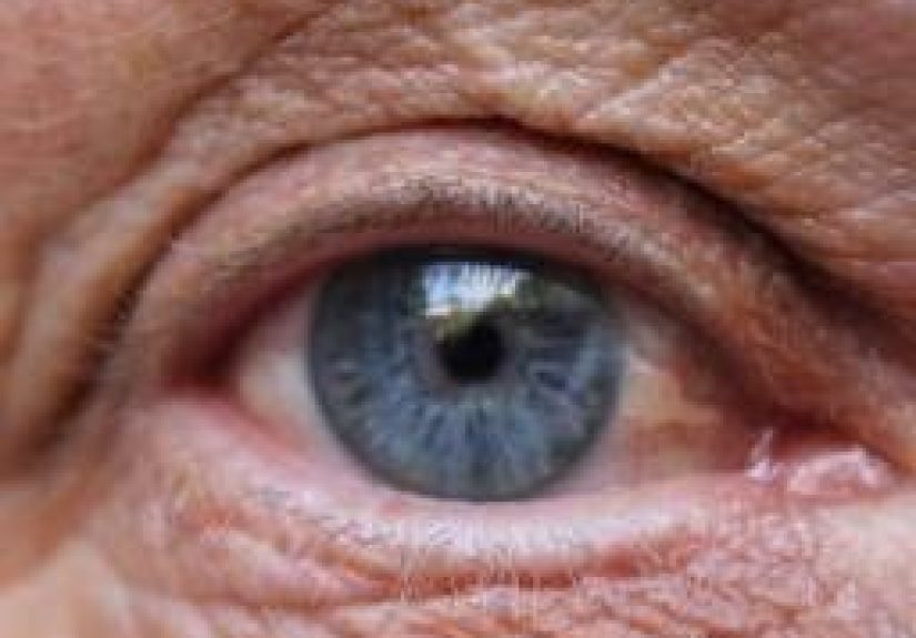 Macular degeneration research gets a boost from large gene study