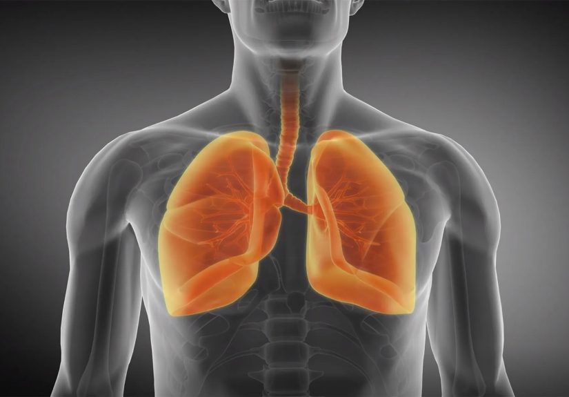 TB Cases Rise in U.S., Particularly Among Young Children