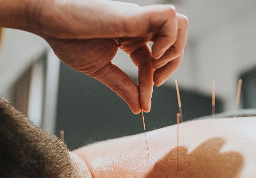 Acupuncture for COPD: Can It Strengthen the Lungs?