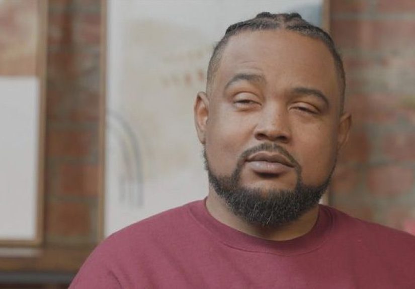 Black Americans and DME: Barriers to Diagnosis and Treatment (Video)