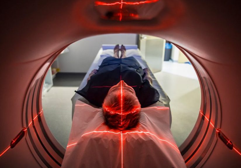 Brain Herniation: Symptoms, Treatment, and More