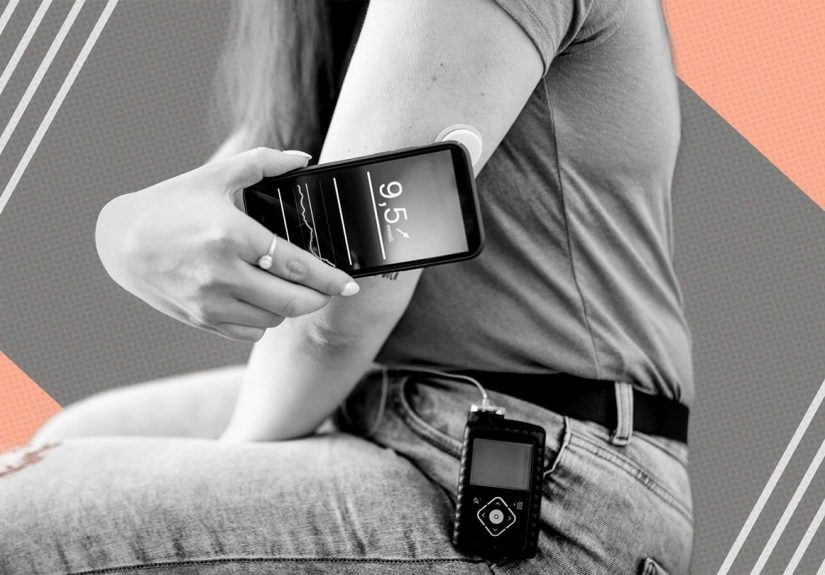 CGM Benefits Type 2 Diabetes Management, 2 New Studies Show