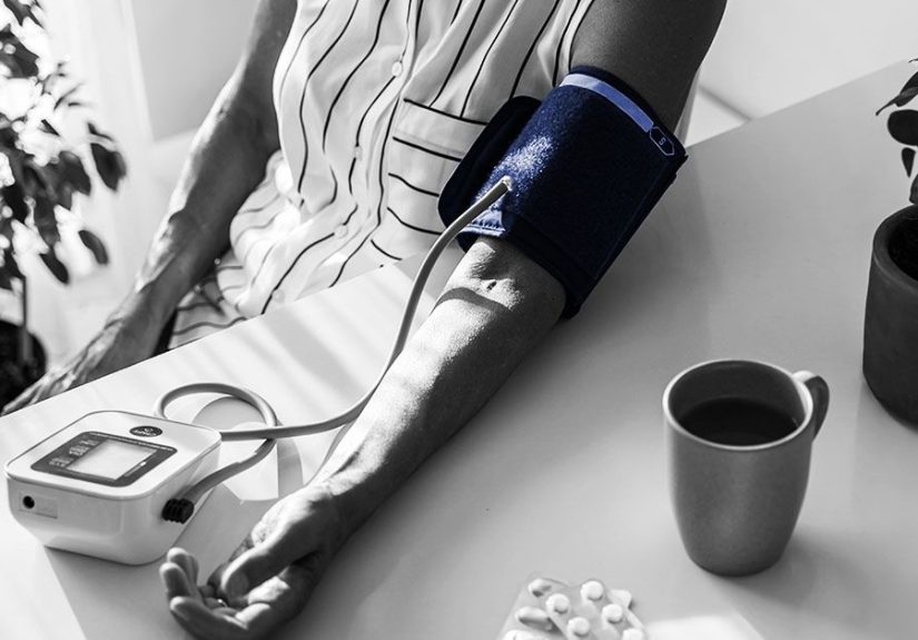 Fusiform aneurysm: Causes, symptoms, and treatment