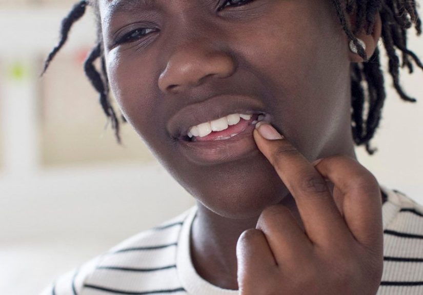 Herpes Incubation Period: Your HSV Questions Answered