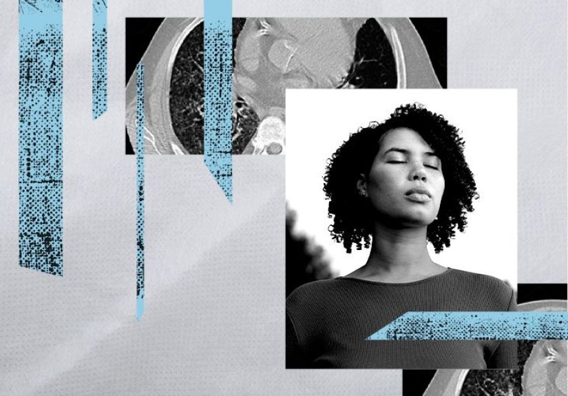 Histoplasmosis in the lungs: Pictures and more