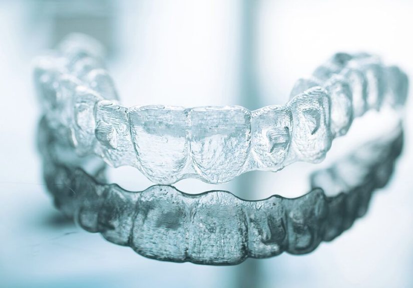 Invisalign Attachments: Benefits, Procedure, Care, and More