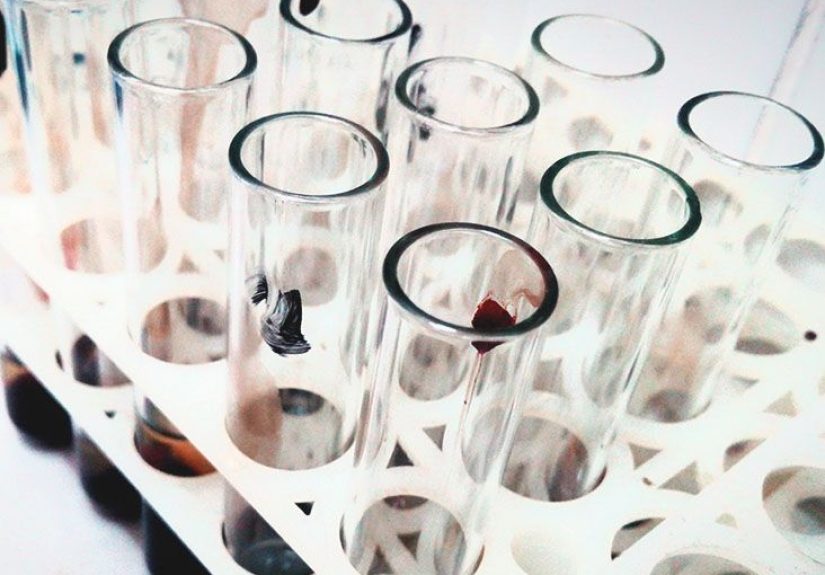 Multiple myeloma C.R.A.B. symptoms: Criteria, outlook, and more