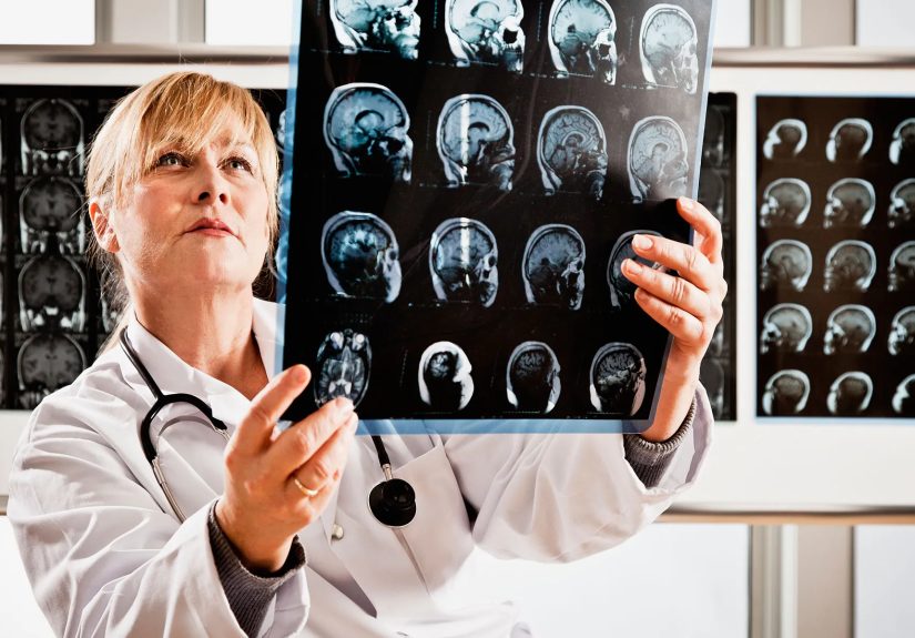 Neurologist for Migraines: What to Expect