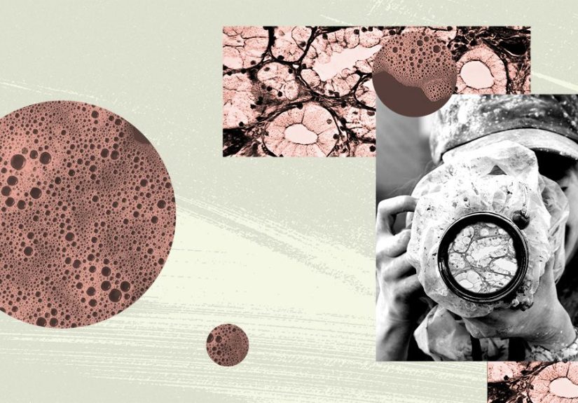 Postpartum Depression Treatment: Types and Effectiveness