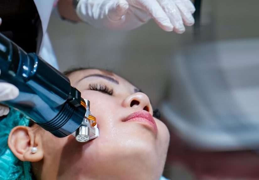 Radiofrequency Microneedling: Procedure, Aftercare, Side Effects, Cost