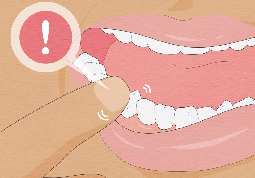 12 Ways to Pull a Loose Tooth at Home