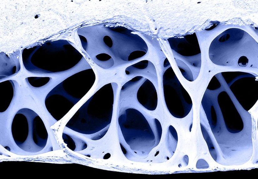 Bone cancer symptoms: Early signs and more