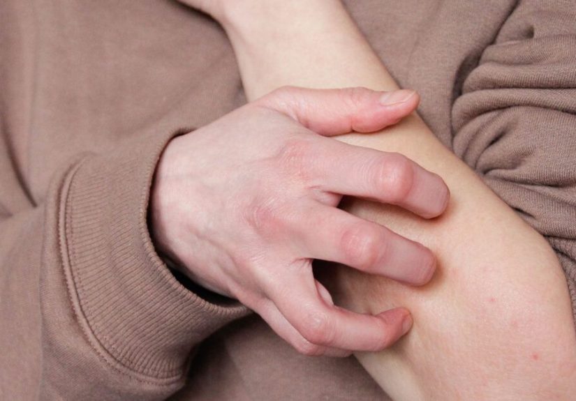 Dupixent for eczema: Get the facts on cost, side effects, and more