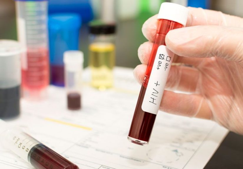 ELISA, Western Blot, and Other Tests for HIV