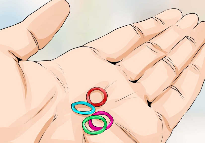 How to Connect a Rubber Band to Your Braces: 12 Steps