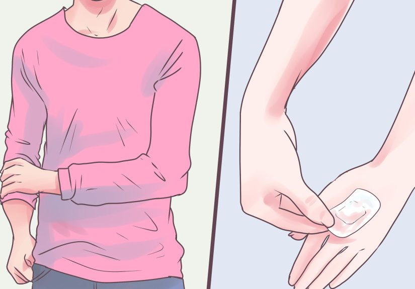 How to Treat Embarrassing Water Warts