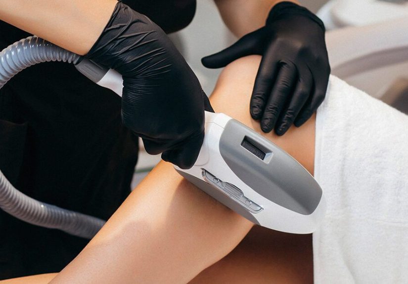 Intense Pulsed Light for Removing Spider Veins: Does It Work?