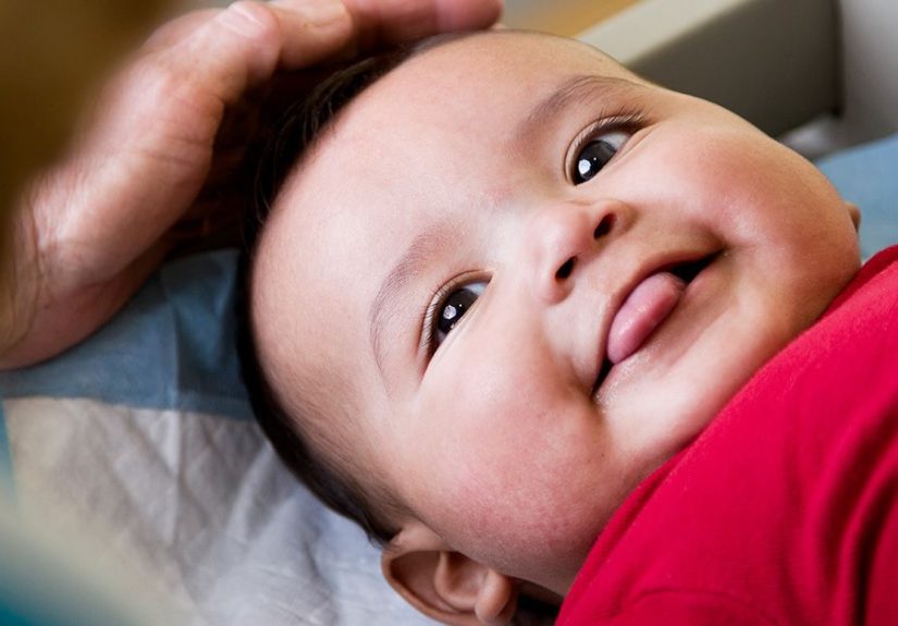 Posterior Tongue Tie Symptoms and Treatments