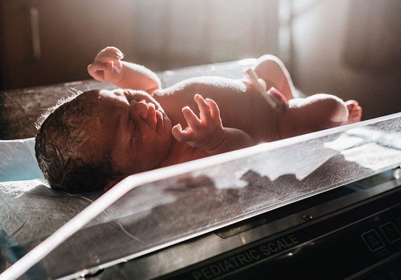 Urachal cyst: Symptoms, causes, and treatment