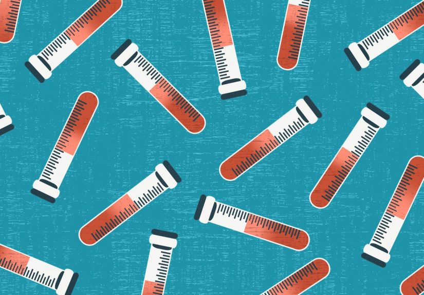 What Are the Stages of Multiple Myeloma?