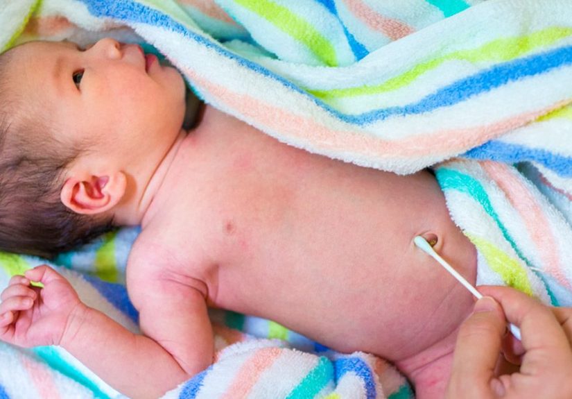 Baby Belly Button: Care, Keeping It Clean, What to Expect