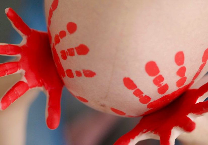 Bloody Show: What to Expect, Why Bleeding Happens, and More