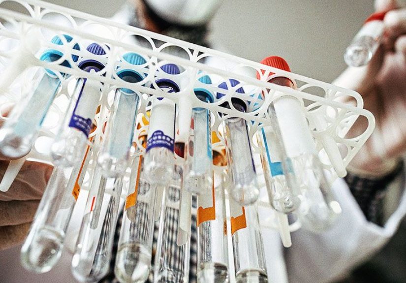 Can People With Anorexia Have High Cholesterol? What to Know