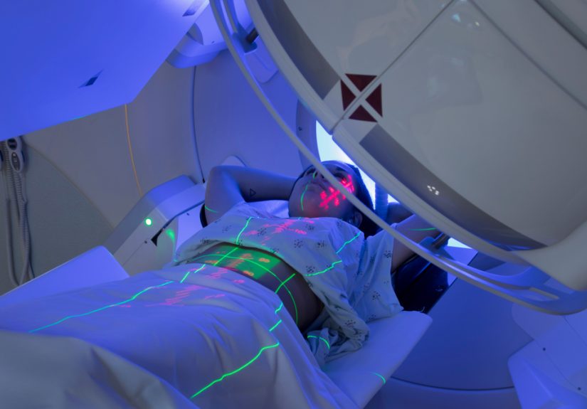 Changes to radiation oncology offer hope when there was none