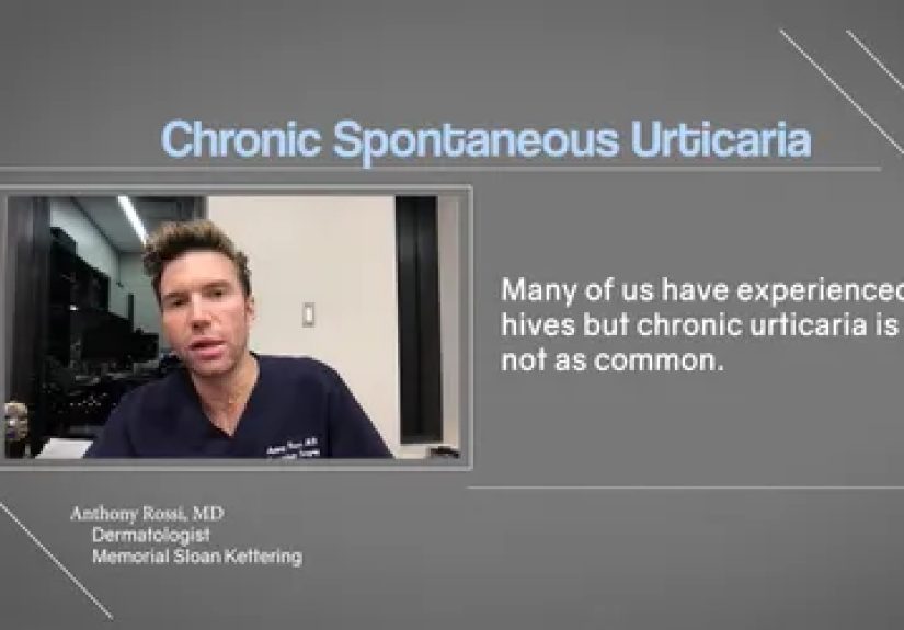 Complications From Chronic Urticaria