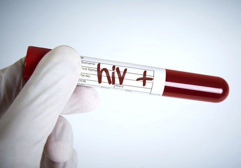 Detecting HIV: Seroconversion Time Is Important