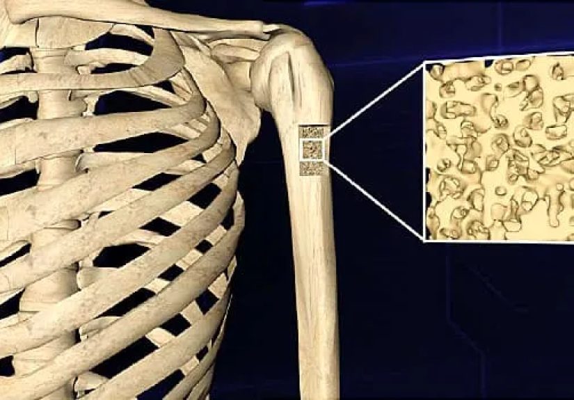 Leukemia: Symptoms and Treatments