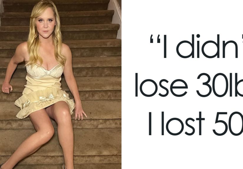 Plastic Surgeon Shares Professional Perspective On Amy Schumer’s Latest Wrinkle-Free Photos