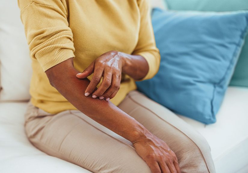 12 Skin Conditions Linked to Ulcerative Colitis