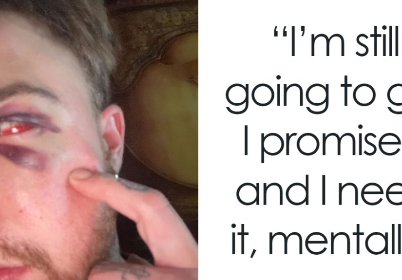 29-Year-Old Trans Man Gets Brutally Beaten Up In Switzerland, Claims It’s A Hate Crime