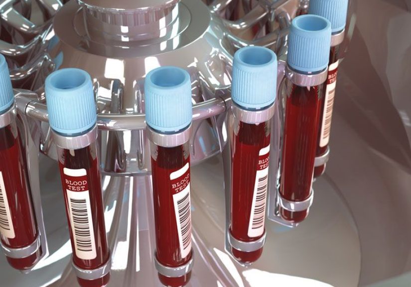 Blood Typing: Purpose, Procedure, and Risks