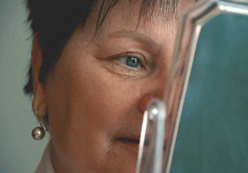 Botox for Crow&rsquo;s Feet: Side Effects, Cost, and Recovery