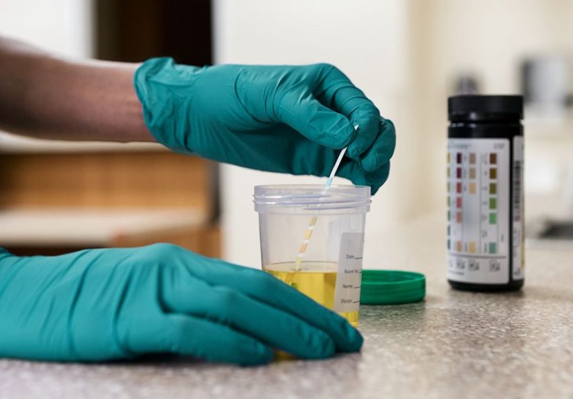 How Long Does It Take for Gonorrhea to Show Up?