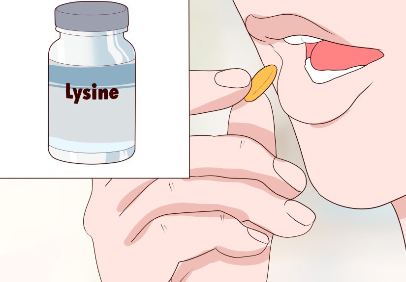 How to Heal a Herpes Outbreak Quickly: 10 Steps