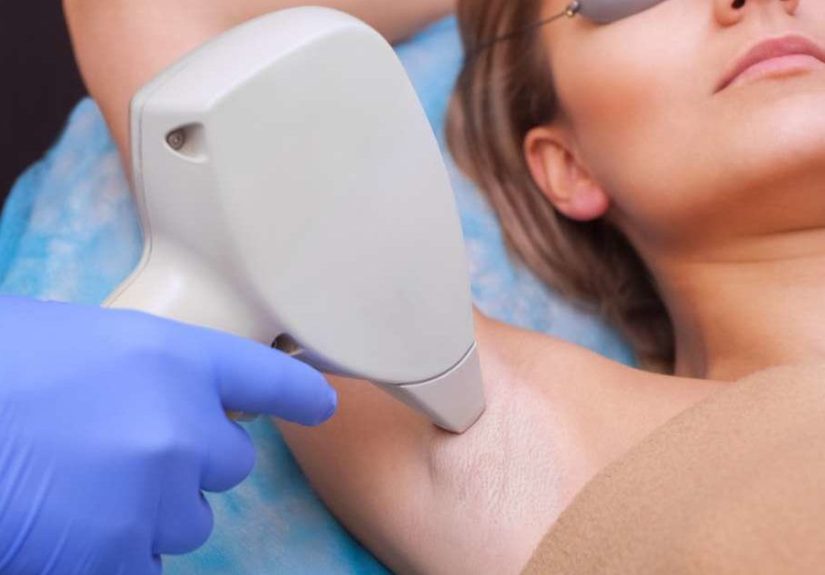 Is laser hair removal permanent, and is it safe?