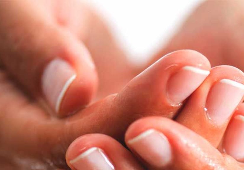Periungual Warts: Identification, Treatment, and More