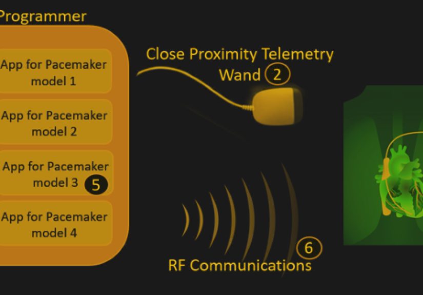 Radio Controlled Pacemakers Are Easily Hacked