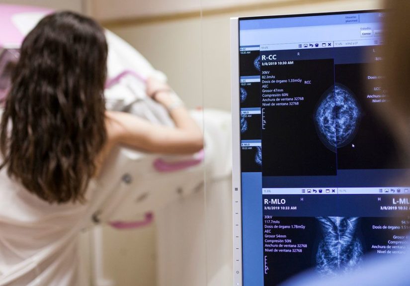 How Often Should You Get a Mammogram?
