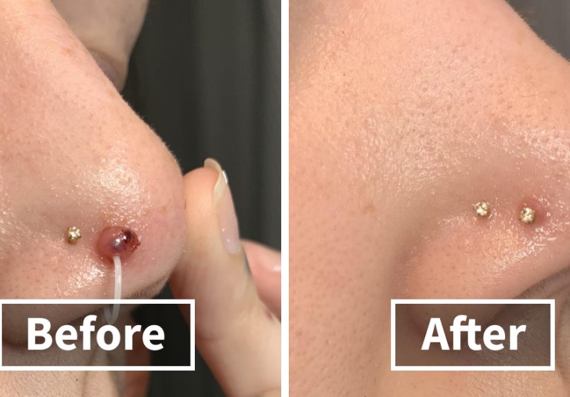 These 24 Before/Afters Are Making Us Poor And We’re Not Mad