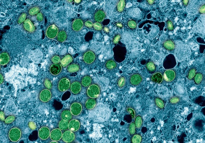 Could the Mpox Outbreak Reach the U.S.?