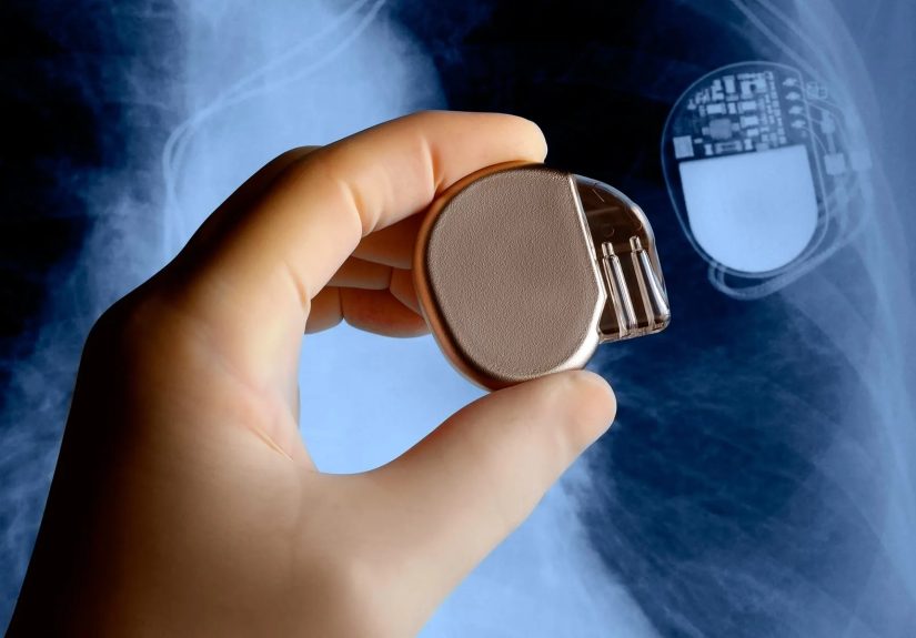 Atrial Fibrillation Treatment: Options for Treating AFib